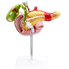 Diseased Pancreas, Spleen and Gallbladder Anatomy Model