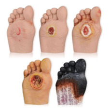 Diabetic Foot Pathology Teaching Model Set