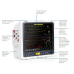 Philips Goldway G30E Multipara Patient Monitor Philips Goldway G30E Multipara Patient Monitor